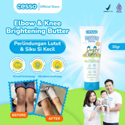 Cessa Elbow & Knee Brightening Butter - Efektif Mencerahkan Dan Menghidrasi Kulit