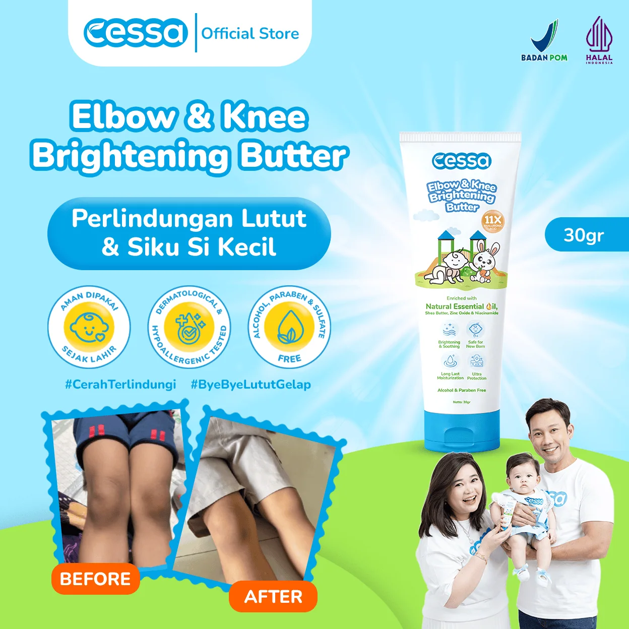 Cessa Elbow & Knee Brightening Butter - Efektif Mencerahkan Dan Menghidrasi Kulit Cessa Elbow & Knee Brightening Butter - Efektif Mencerahkan Dan Menghidrasi Kulit