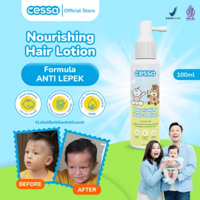 Cessa Nourishing Hair Lotion - Healthy & Shiny Hair 100 Ml